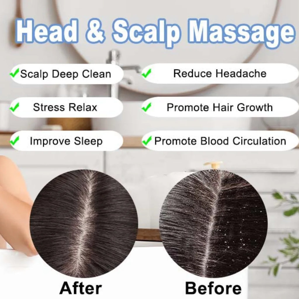 Scalp Massager Portable Electric Scalp Massager Hair Growth,Waterproof Handheld Head Scratcher Massager,3 Speed Modes with 8 Massage Claws Cat Massager(Purple)